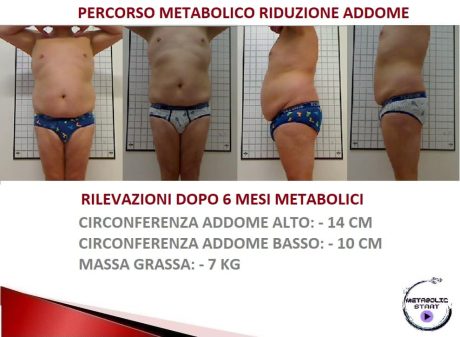 percorso addome vip Torrevecchia Teatina-min